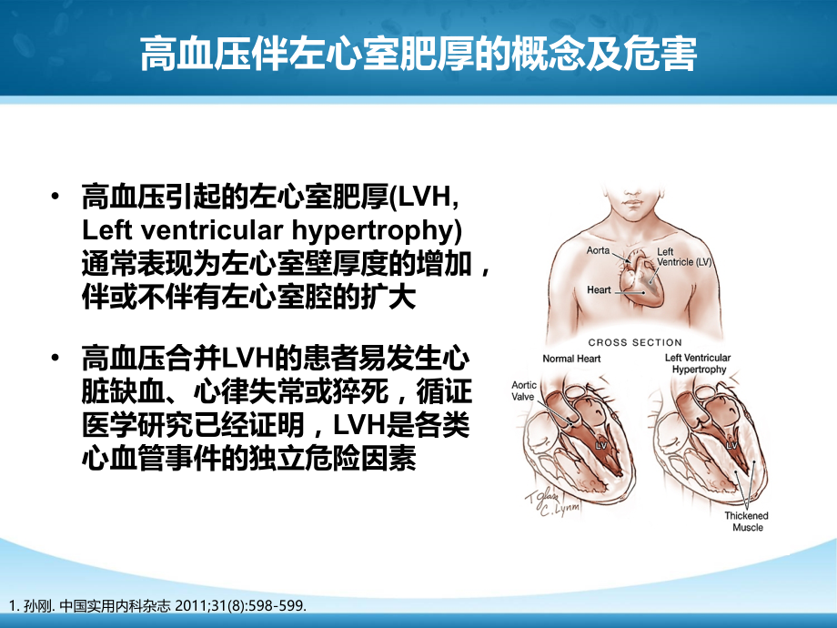 左心室肥厚高血压靶器官损伤的重要干预靶点-课件.pptx_第2页