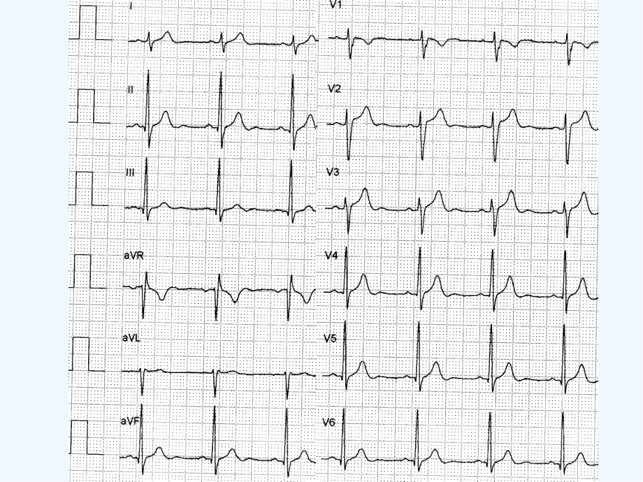 内科学课件窦性心律失常.pptx_第2页