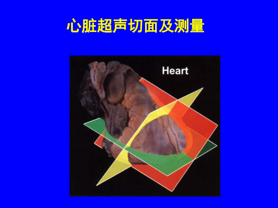 心脏超声标准切面及测量课件.ppt_第1页