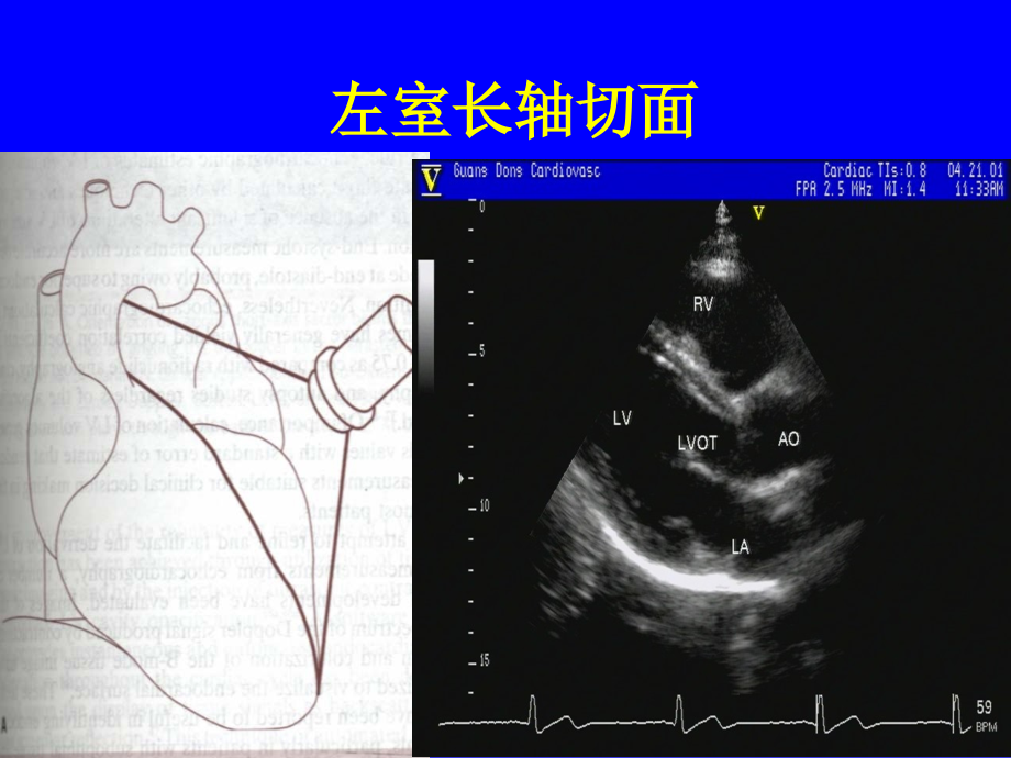 心脏超声标准切面及测量课件.ppt_第2页