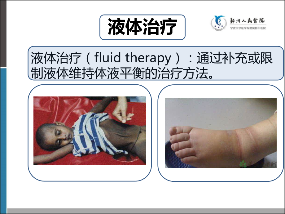 液体复苏中CVP的再讨论课件.pptx_第2页
