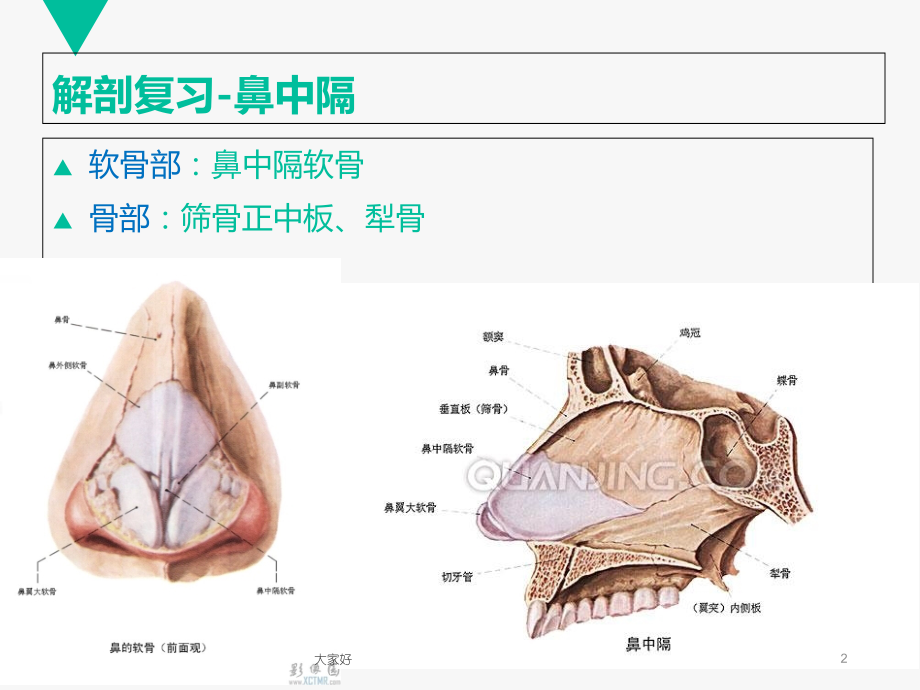 鼻中隔偏曲课件.ppt_第2页