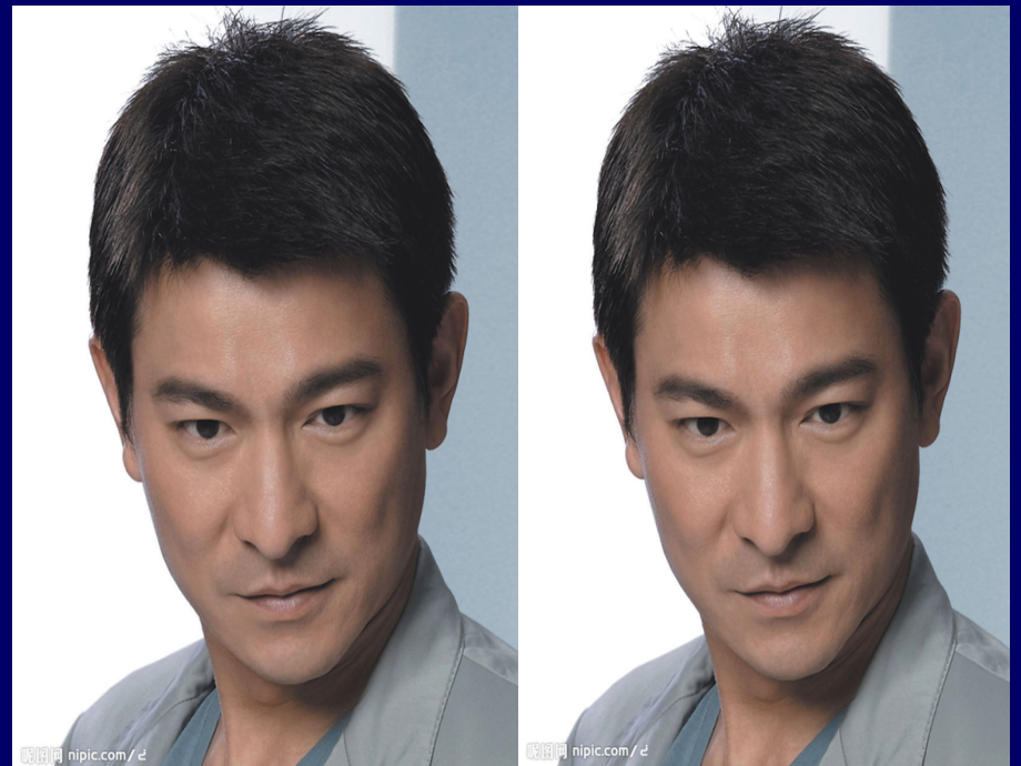 慢性乙型肝炎课件.ppt_第2页