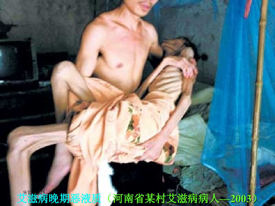 流行病学08.ppt_第2页