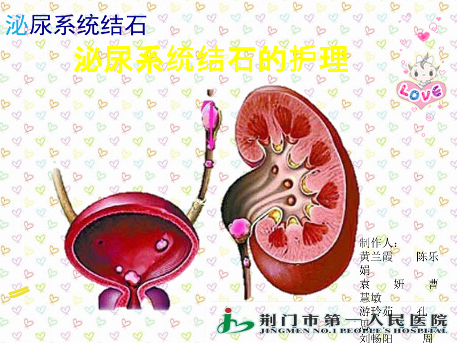 泌尿系统结石的护理课件.pptx_第1页