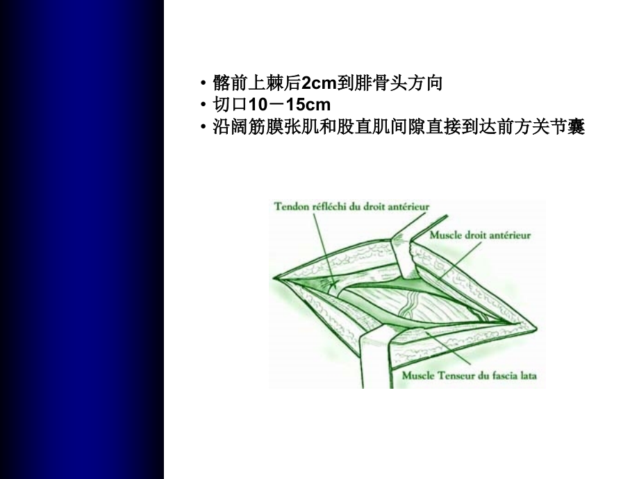 全髋关节置换手术入路课件.ppt_第2页
