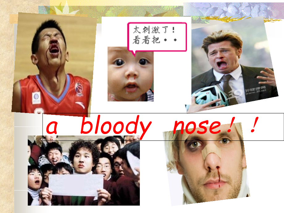 鼻出血专题知识讲座.pptx_第2页