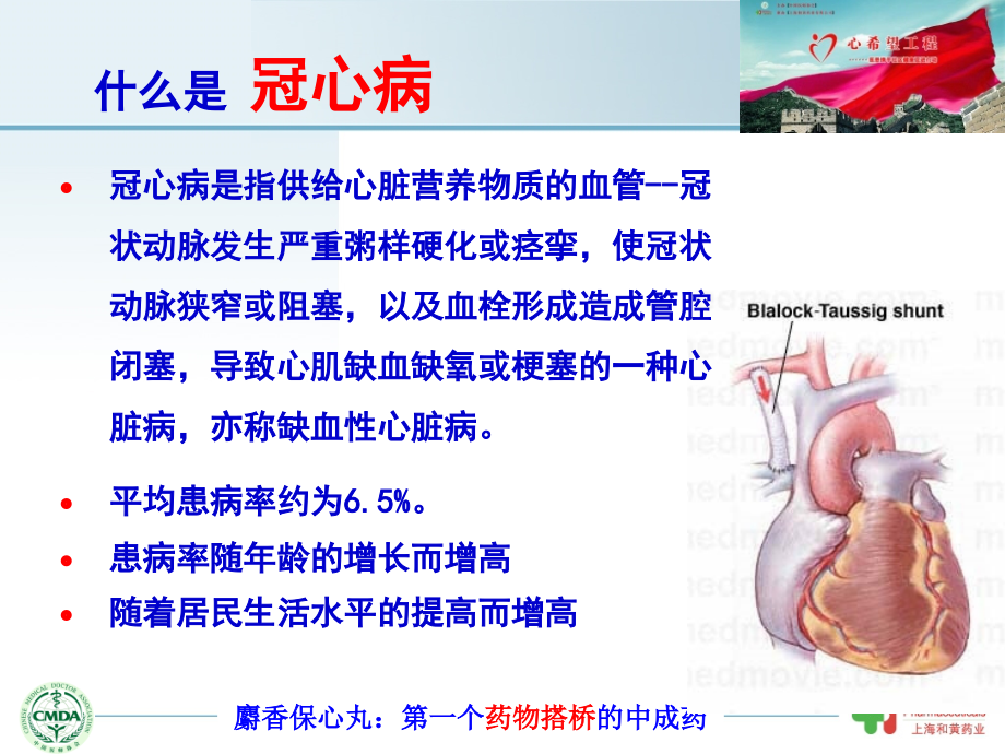 冠心病早防早治.ppt_第2页