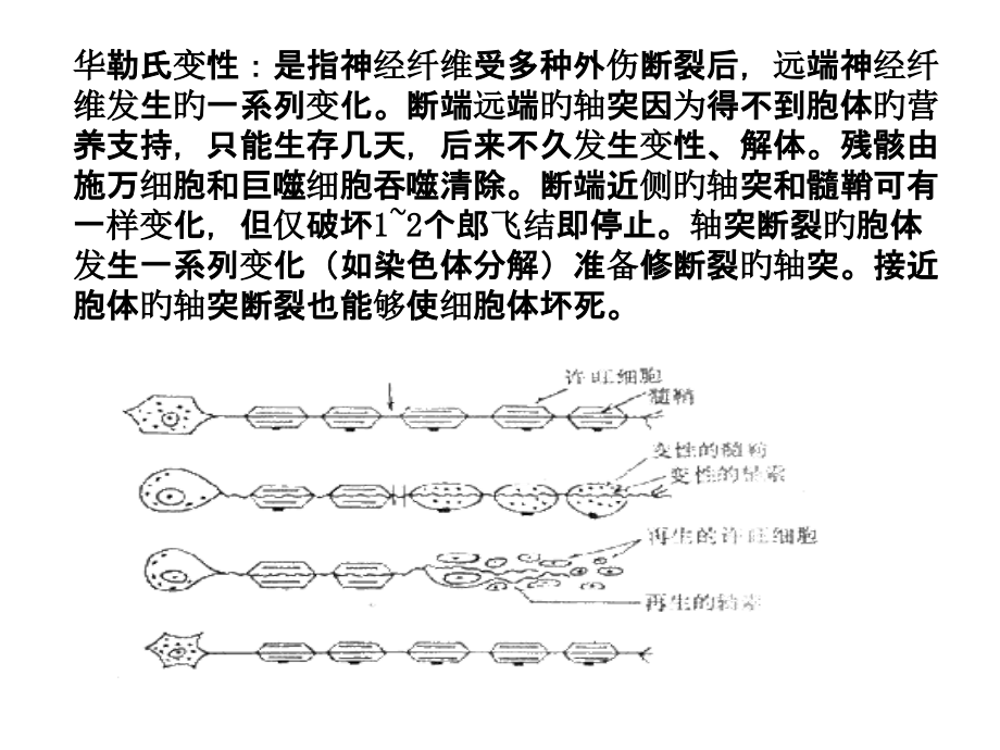 华勒氏变性影像学表现.pptx_第2页