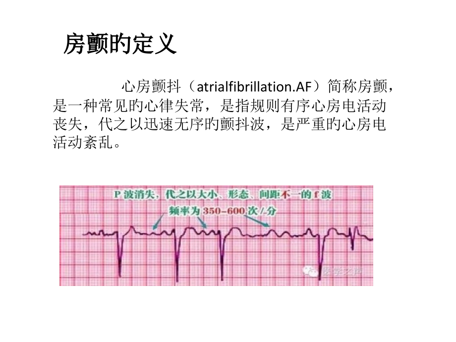 房颤治疗策略.pptx_第2页
