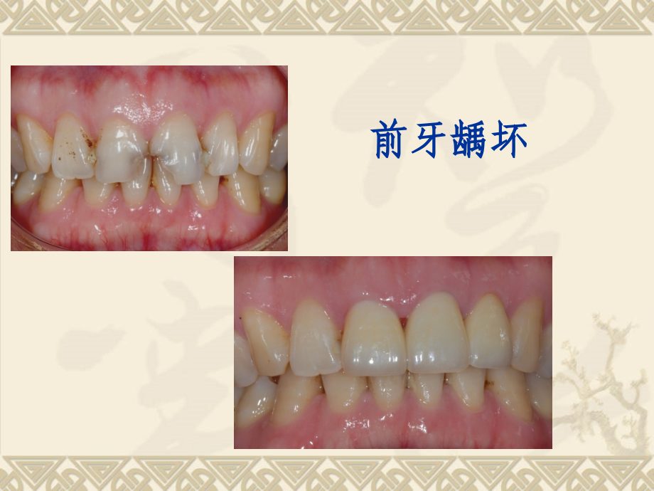 口腔修复医患沟通课件.pptx_第2页