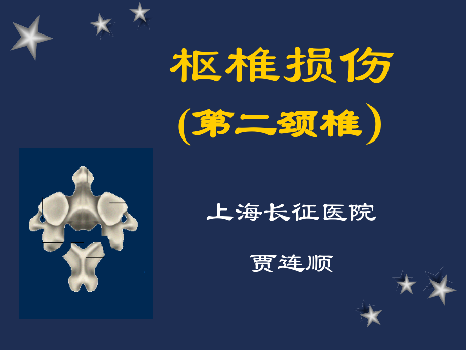 枢椎骨折解析.pptx_第1页