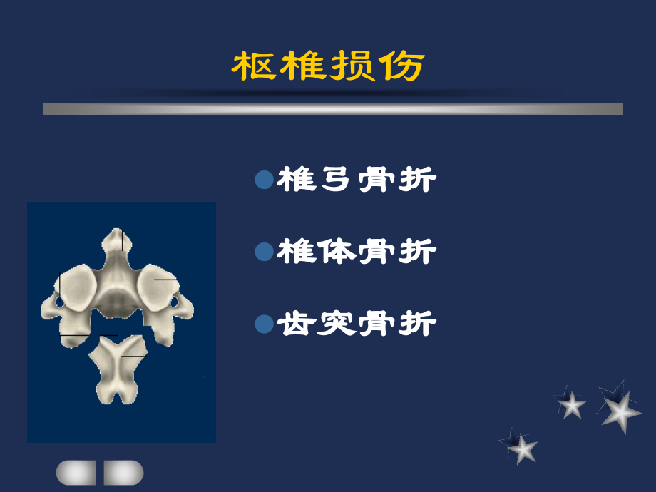 枢椎骨折解析.pptx_第2页