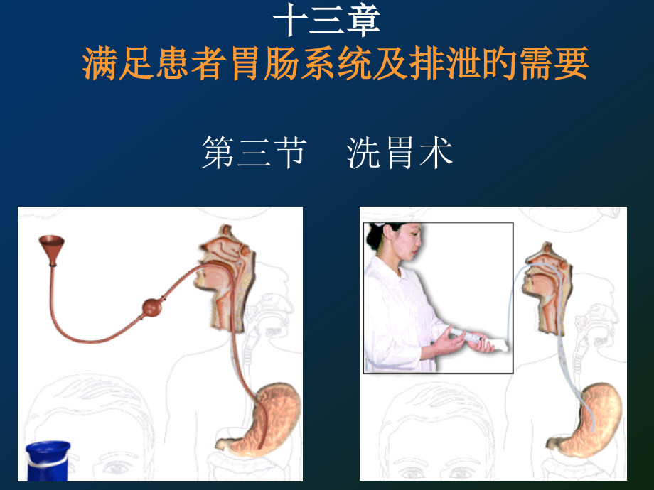 洗胃专题知识讲座.pptx_第1页