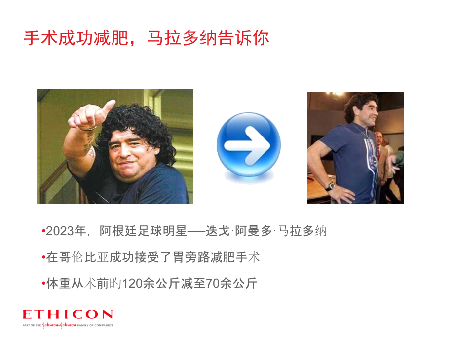 减肥及代谢手术.pptx_第2页