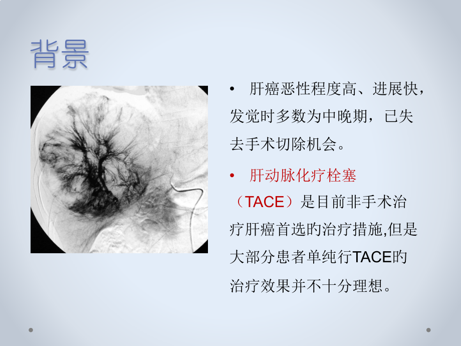 肝癌局部治疗.pptx_第2页