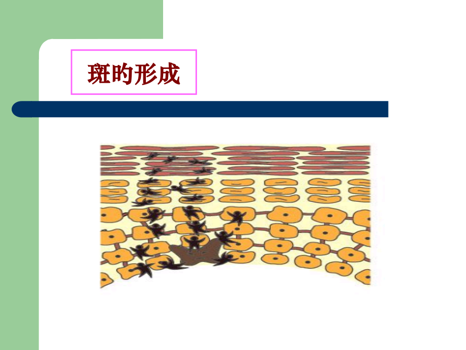 问题性皮肤全解.pptx_第2页
