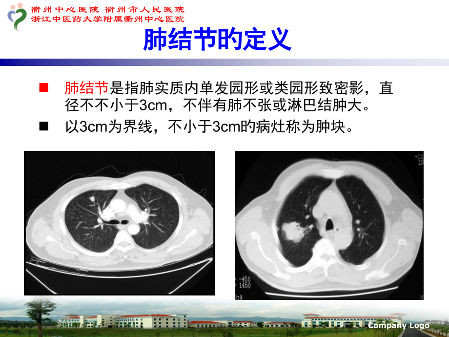 低剂量螺旋CT检测肺结节.pptx_第2页