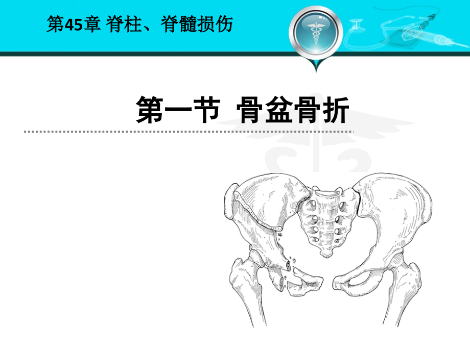 骨盆髋臼骨折全解.pptx_第2页