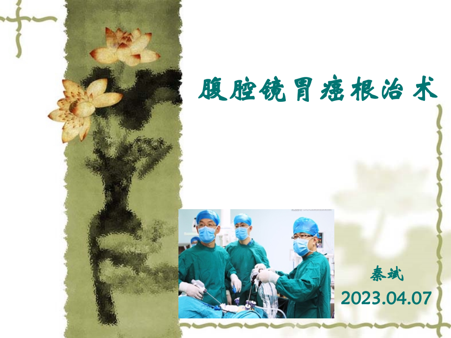 腹腔镜胃癌根治术.pptx_第1页