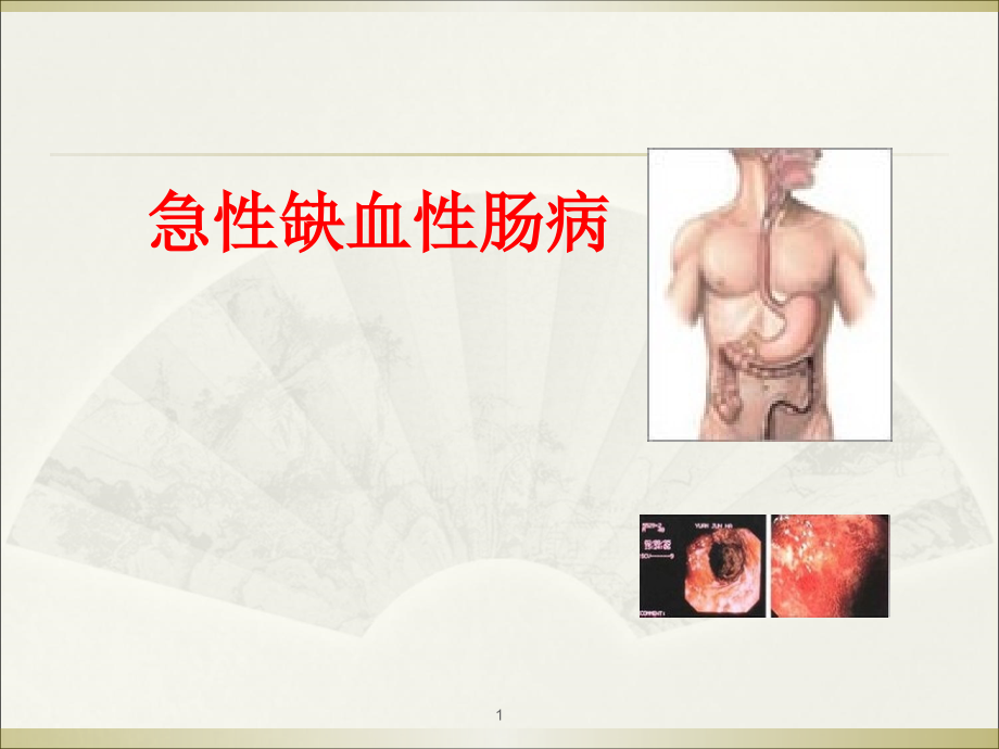 缺血性肠病!医学.pptx_第1页