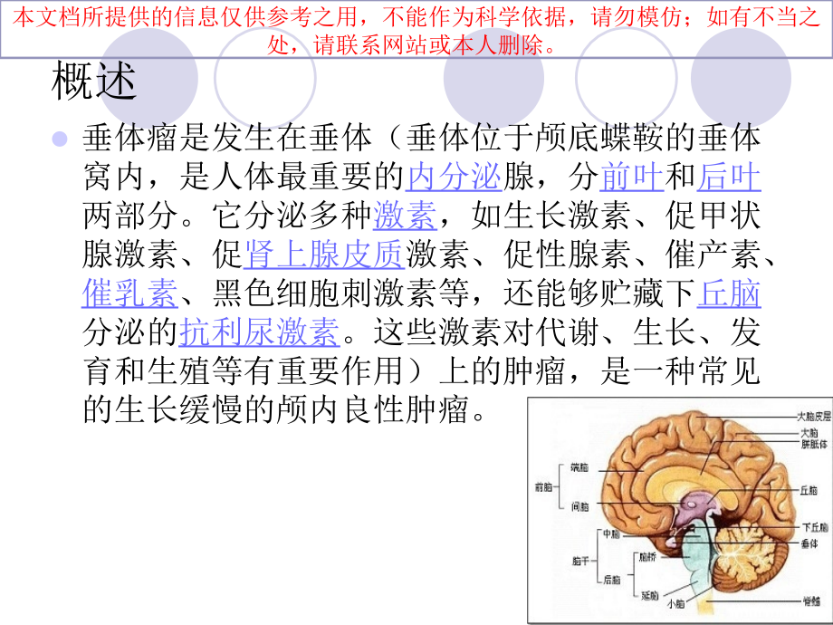 经蝶垂体瘤讲解.ppt_第2页