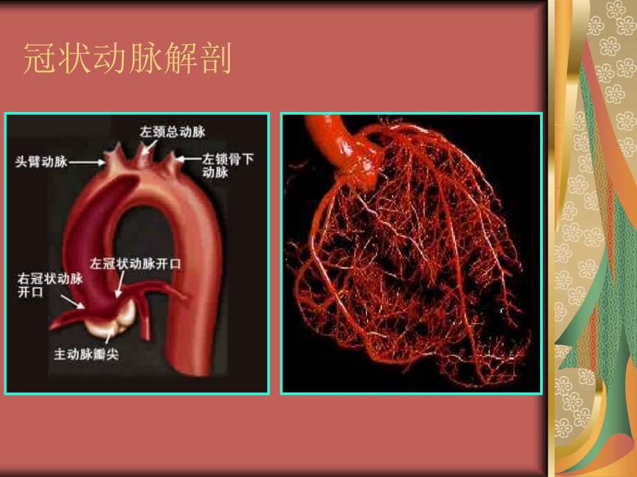 经桡动脉冠脉造影课件.ppt_第1页