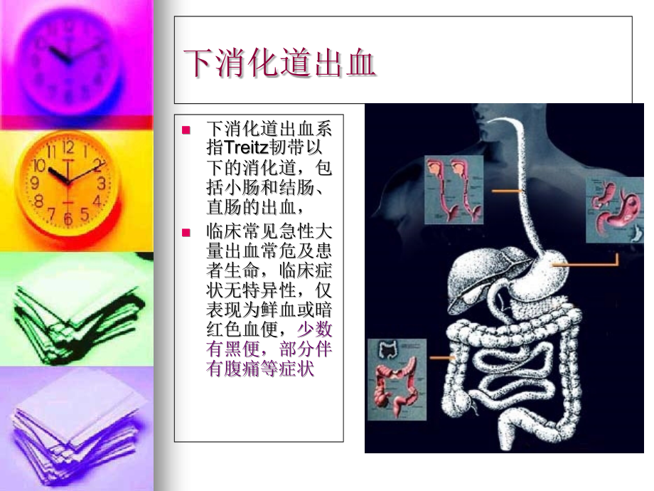 下消化道出血+腹痛.ppt_第2页