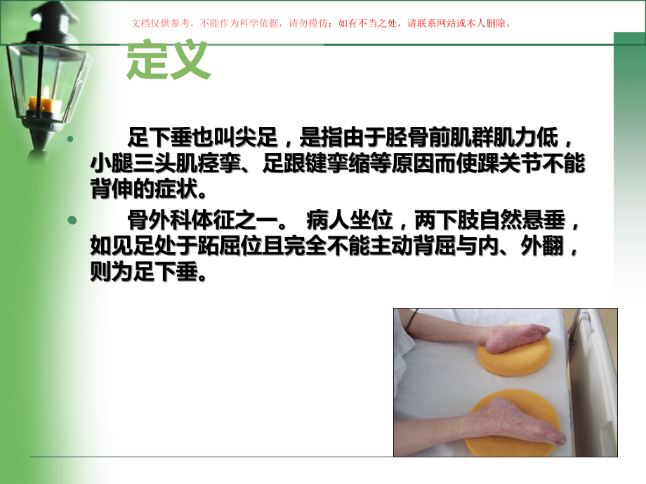 足下垂的防治和护理课件.ppt_第2页