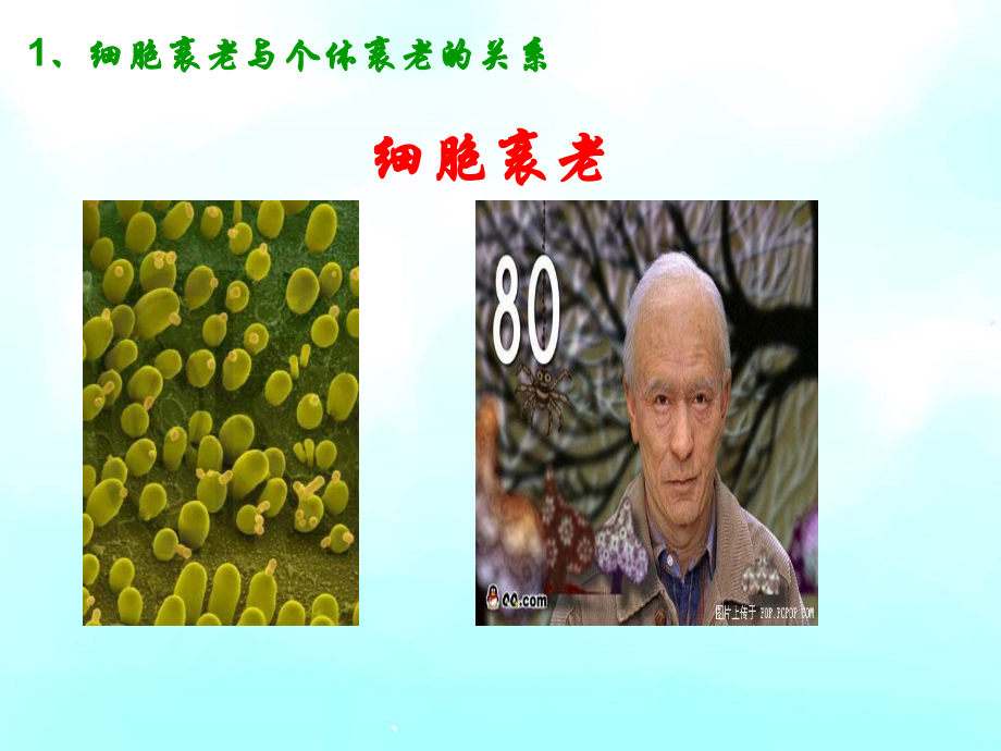 医学细胞的衰老和凋亡以和细胞癌变.ppt_第2页