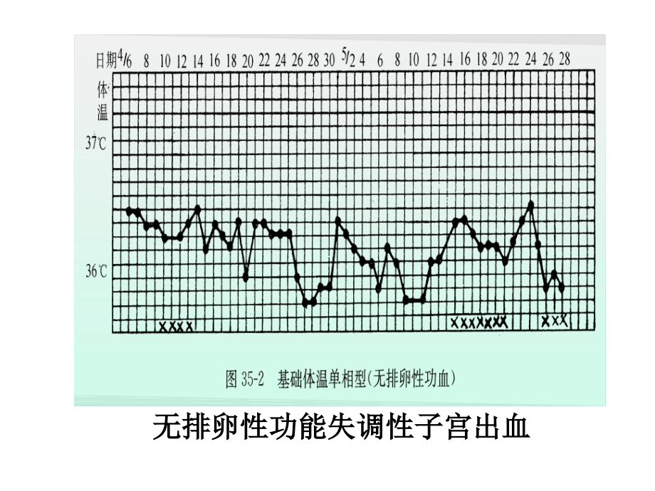 妇科操作.ppt_第2页