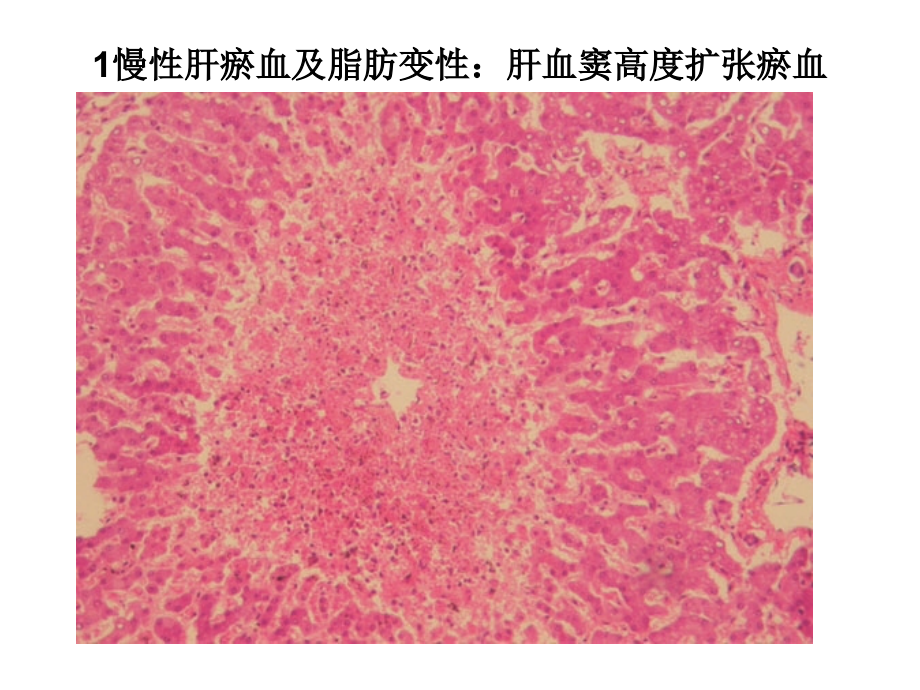 病理辅导2.ppt_第1页