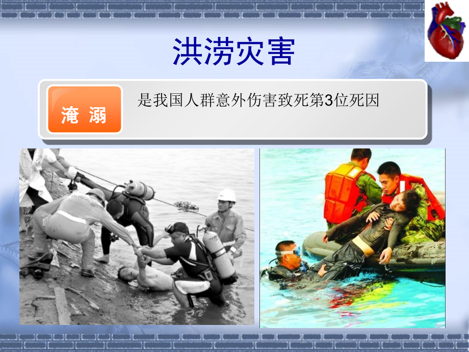 呼吸心跳骤停的处理及心肺复苏.ppt_第2页