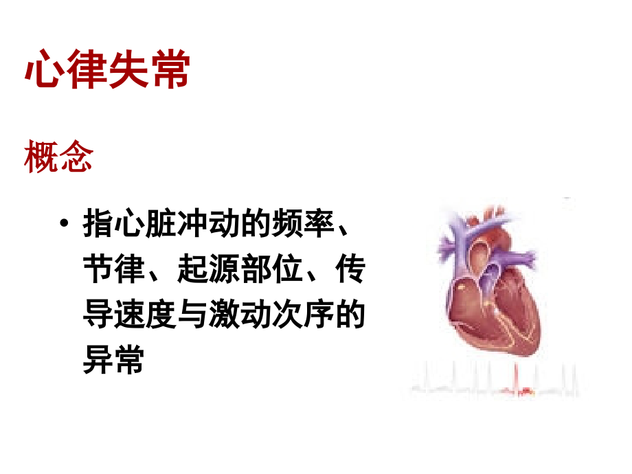 心律失常病人的护理PPT优质课件.ppt_第2页