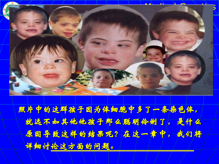 染色体畸变和染色体病.ppt_第1页