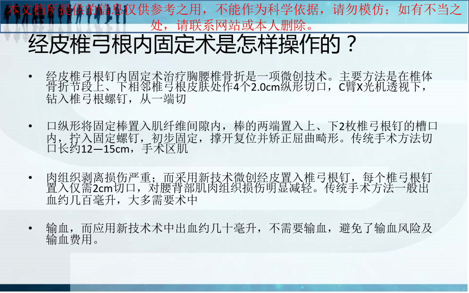 经皮椎弓根内固定医疗护理查房.ppt_第2页