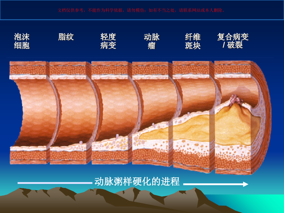 冠心病诊疗和治疗指南培训课件.ppt_第2页
