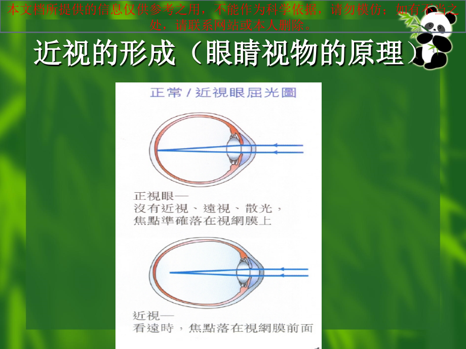 爱护眼睛预防近视宣讲.ppt_第2页