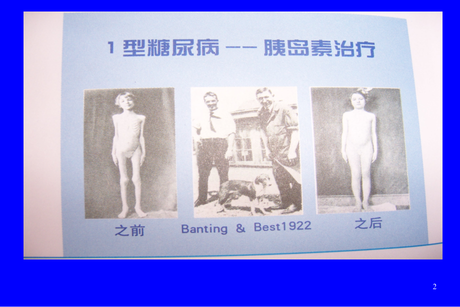 胰岛素治疗幻灯(滨洲03.10.11).ppt_第2页