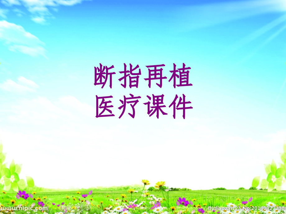 断指再植ppt培训课件.ppt_第1页