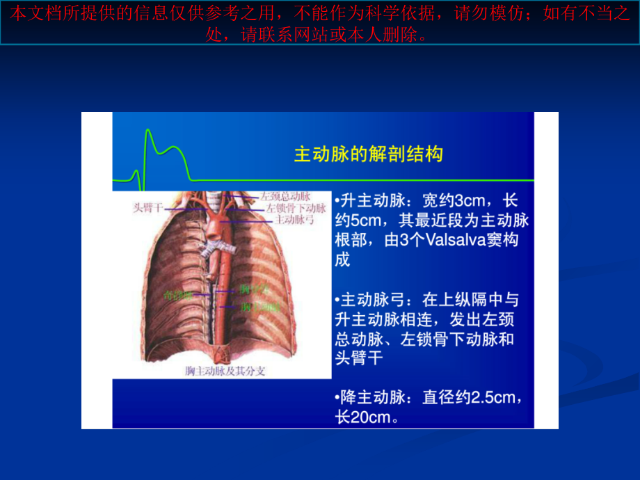 主动脉夹层专题知识讲座培训课件.ppt_第2页