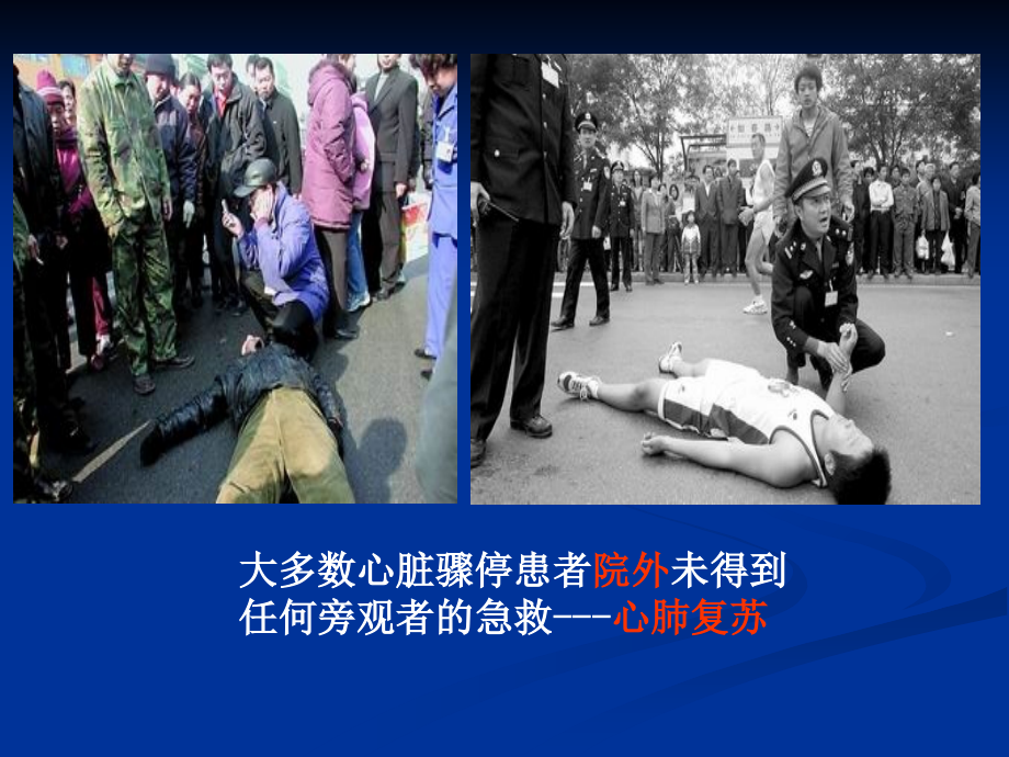 心脏骤停抢救策略.ppt_第2页