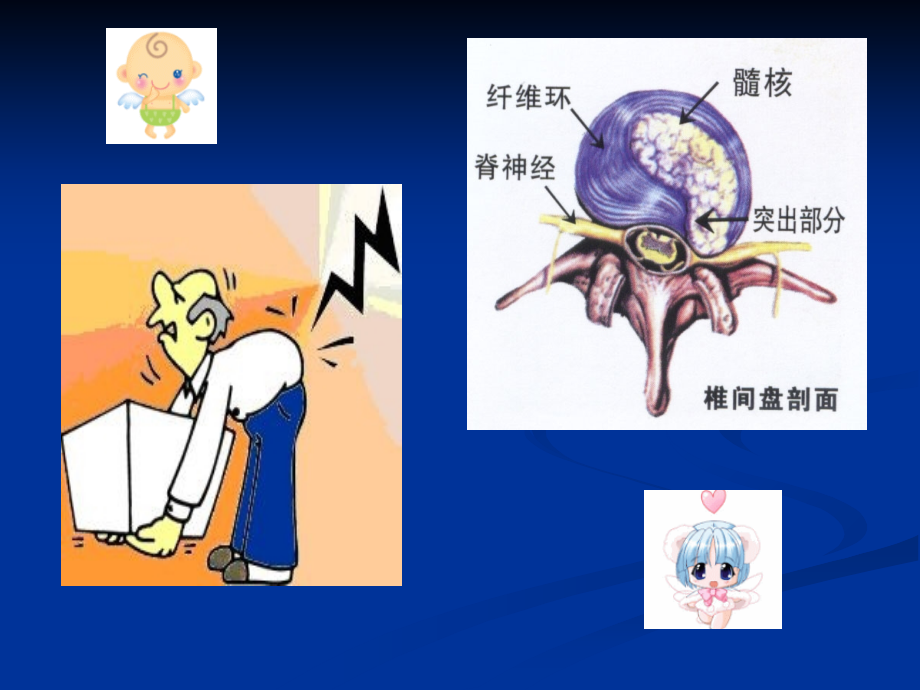 PPT医学课件腰椎间盘突出的健康教育讲义.ppt_第1页