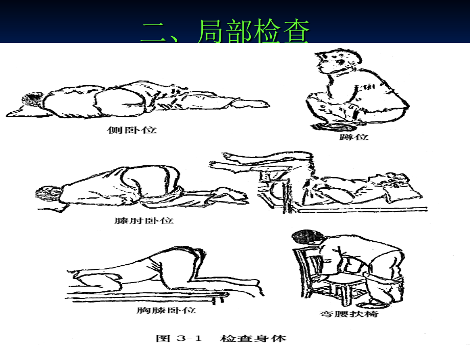 肛肠专科检查法-医学课件.ppt_第2页