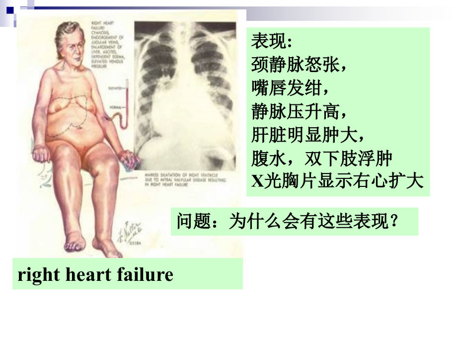 病理生理学绪论学习.ppt_第1页