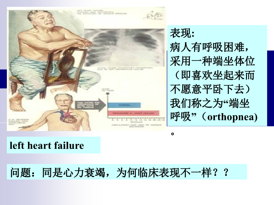 病理生理学绪论学习.ppt_第2页