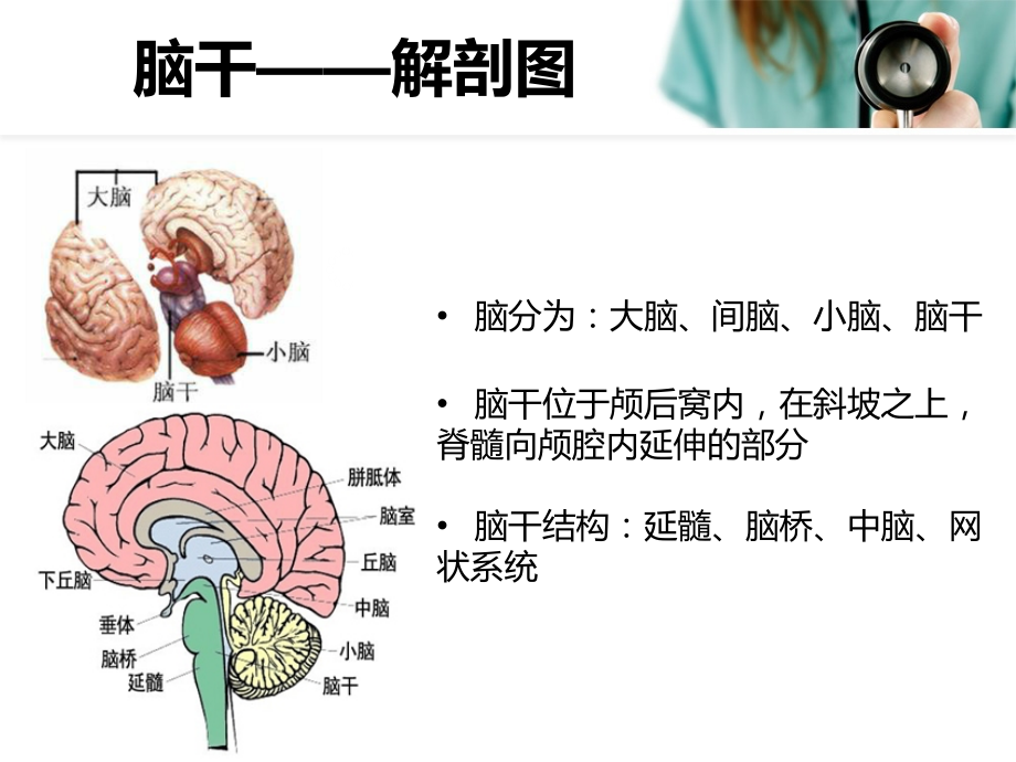 延髓梗塞医疗讲义.ppt_第2页
