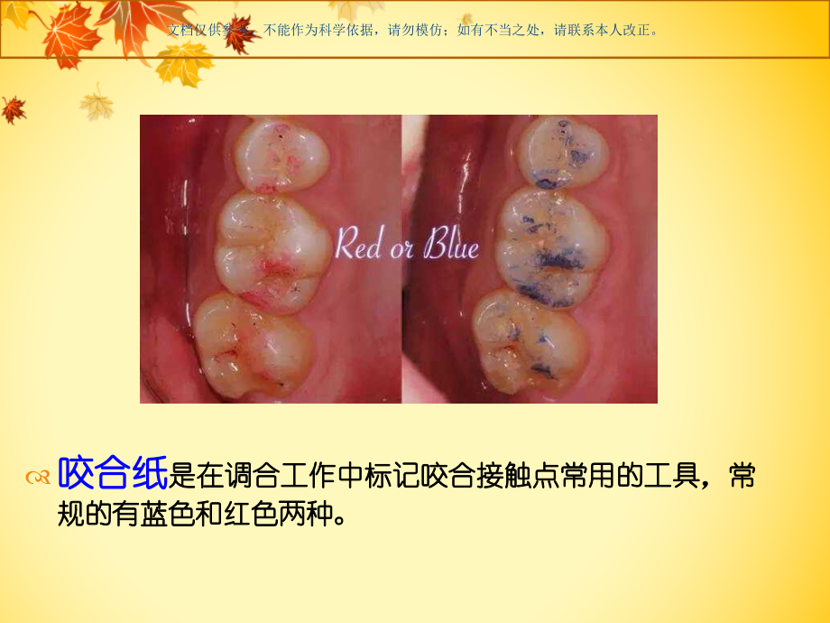 咬合纸的用法课件.ppt_第1页