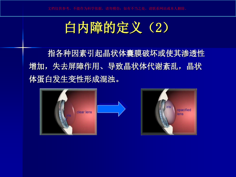 五官科学医学知识专题讲座培训课件.ppt_第2页