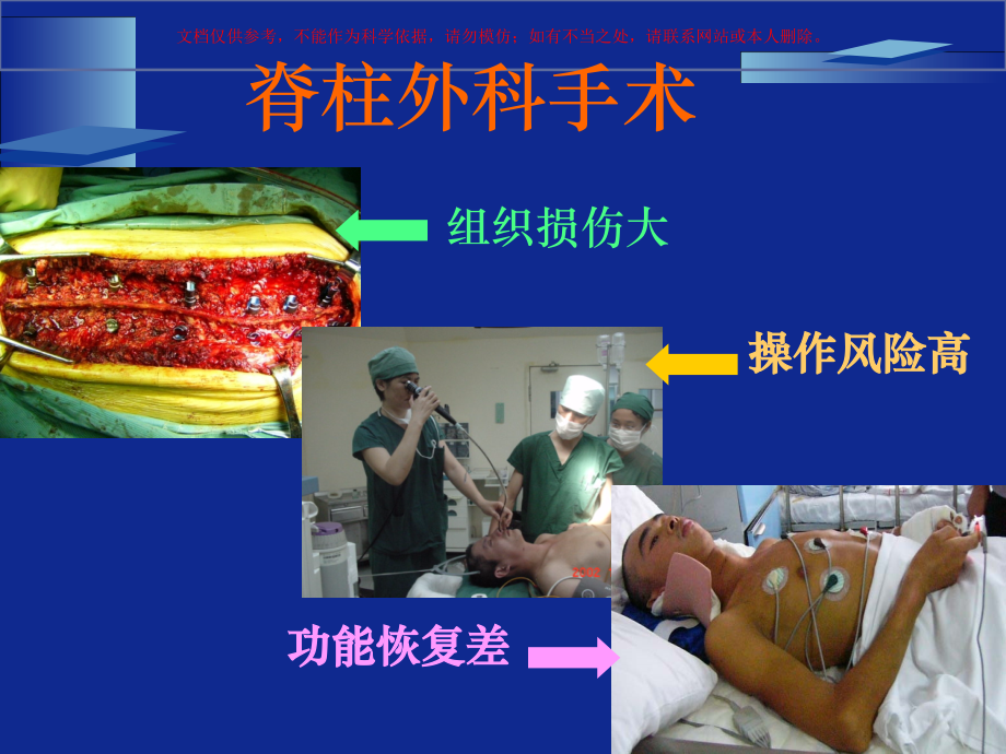 脊柱外科的微创意识微创观念与微创技术.ppt_第1页